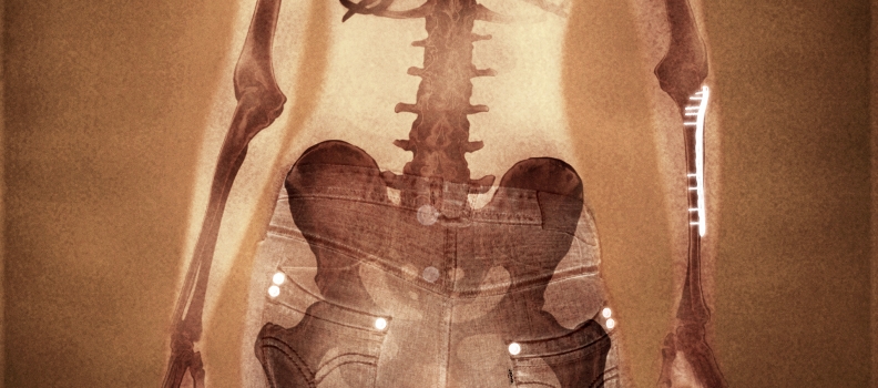 018 levis_girl_xray